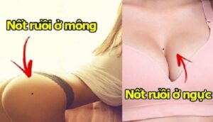 Nốt Ruồi Vùng Kín Tốt Hay Xấu? Ý Nghĩa Như Thế Nào? 8 Nốt ruồi ở vùng kín