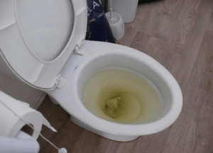 LÀM GÌ KHI BỒN CẦU BỊ TẮT? MÁCH BẠN 6 CÁCH HAY THÔNG TẮT DƯỚI ĐÂY