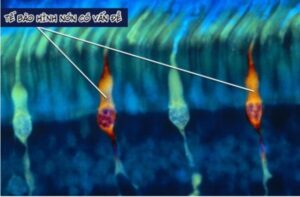Bảng Test Mù Màu Chuẩn Chính Xác Nhất 2022 4 test mù màu, bảng test mù màu, test mù màu chuẩn, bài test mù màu, test mù màu online, mù màu, mù màu là gì, kính mù màu, bị mù màu, mù màu hoàn toàn, mù màu đa sắc, ở người bệnh mù màu, người bị mù màu, mù màu có chữa được không, kiểm tra mù màu